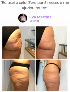 Celul Zero Funciona!