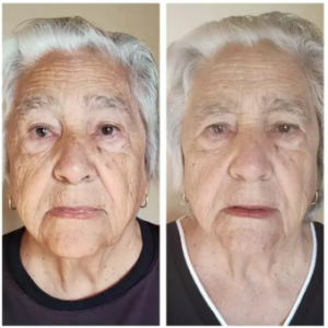 Rosa Mosqueta Amazônica