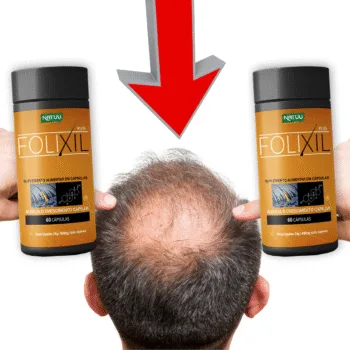 Anti Calvície Folixil Funciona? Novo Tratamento Para Calvície!